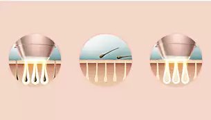 EyeBrow